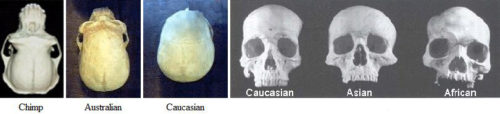 skull comparison