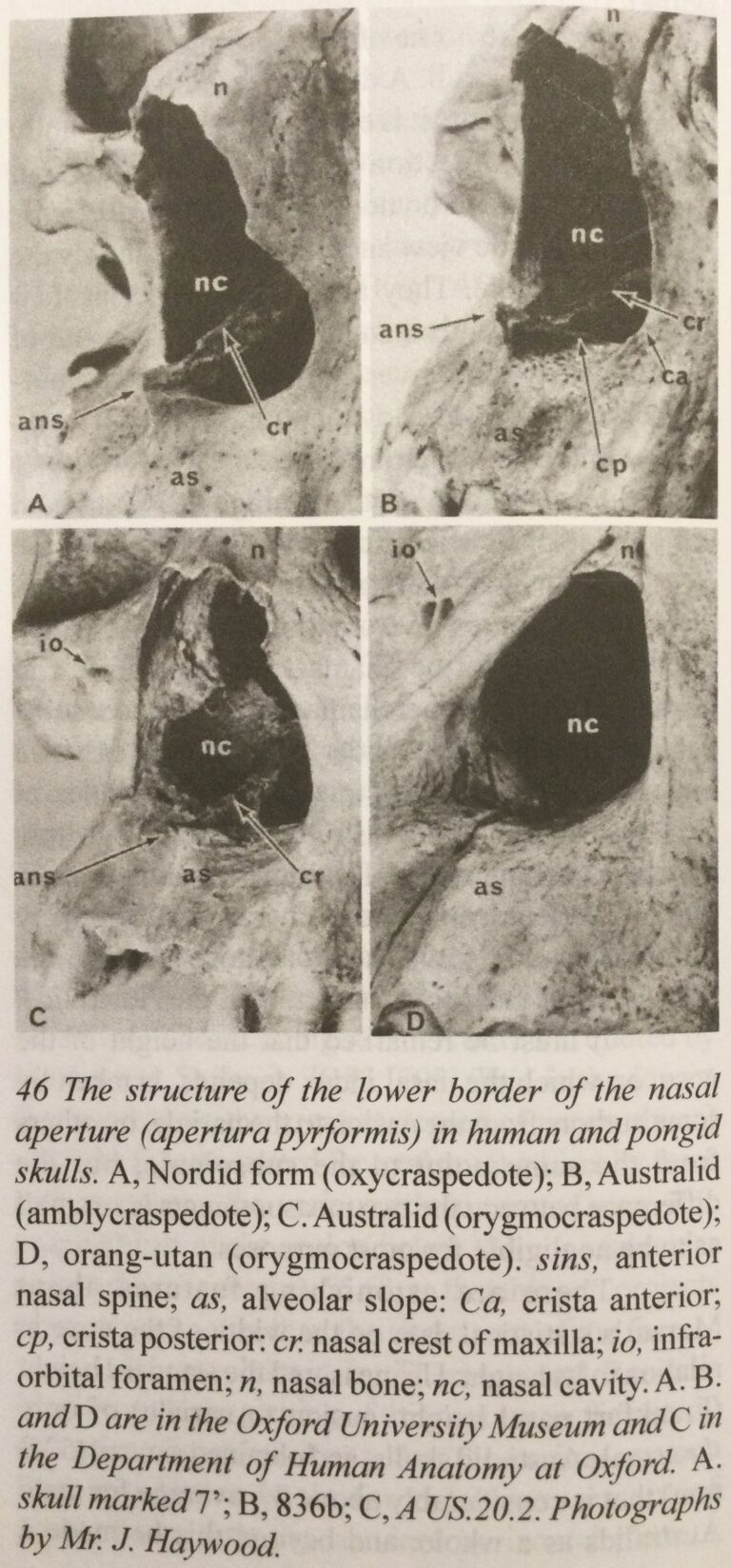 Australoid Skull Features Prove Deep Racial Differences | National Vanguard